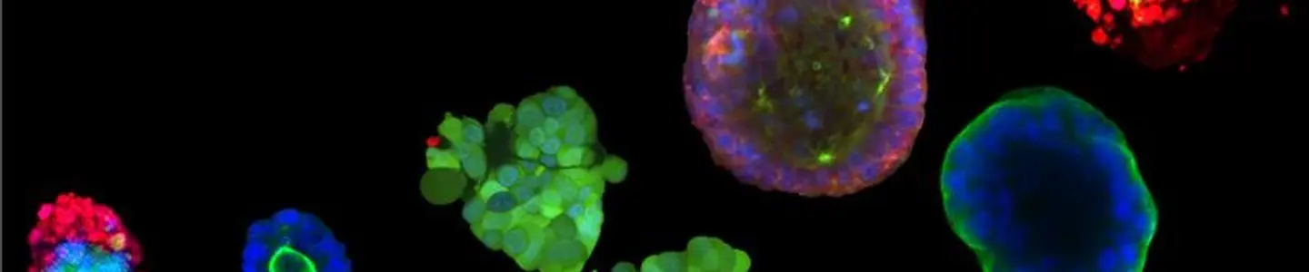 A fluorescence microscopy panel displays multiple organoids of varying sizes and shapes, each labeled with different fluorescent markers in red, green, and blue. The organoids show diverse structural and cellular organization against a black background.