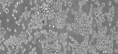 Small, gray and white mouse myeloma cells.