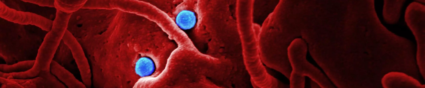 Bright blue balls lodge in a red, porous Middle East Respiratory syndrome coronavirus cluster.