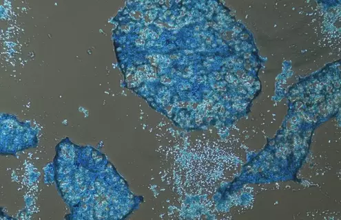 Cluster of blue, porous mesenchymal stem cells