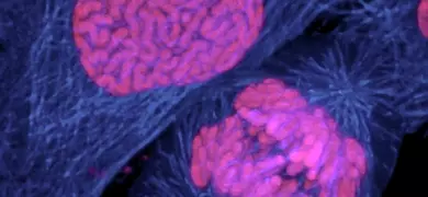 Human Breast Cancer cell dividing.jpg