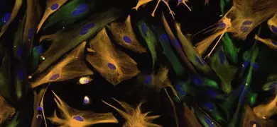 Brown and blue neural progenitor stem cells.