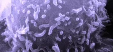 Lavendar lyphocyte sphere with worm-like strands.