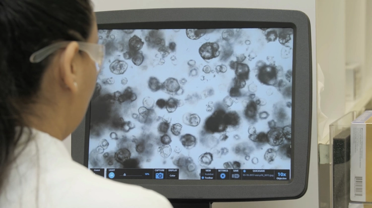 A person is looking at a computer screen displaying a microscopic image of cells in black and white, with some cells appearing darker than others.