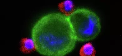 Fluorescent microscopy image of H1650 lung cancer cells showing green cell membranes, blue nuclei, and red surrounding structures against a black background.