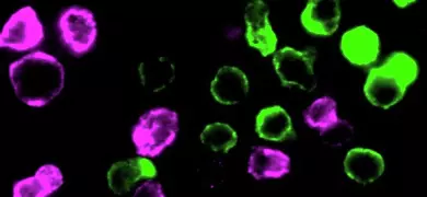 Floating, fluorescent pink and lime green spheres against a black background. The spheres are irregularly shaped and scattered throughout the image.