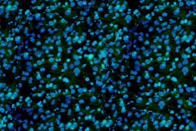 Blue and green fibroblast cells.