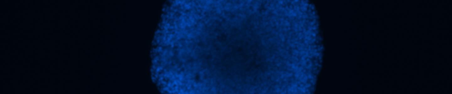 Neural progenitor cell derived neurosphere