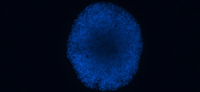 Neural progenitor cell derived neurosphere