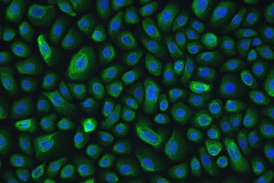 Green and blue NuLi lung epithelial small airway cells.