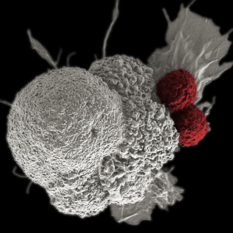 Cancer immunotherapy white oral squamous red cytotoxic T-cells