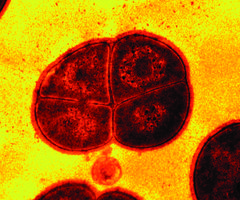 Grainy red and black Deinococcus radiodurans extremophilic bacterium.