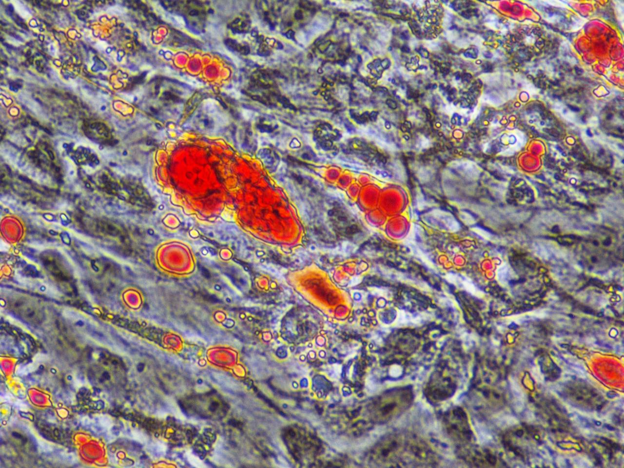 Differentiated WAT cells 40x4