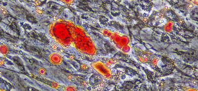 Differentiated WAT cells 40x4