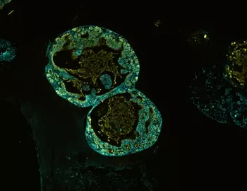 Green ECAD organoid cells.