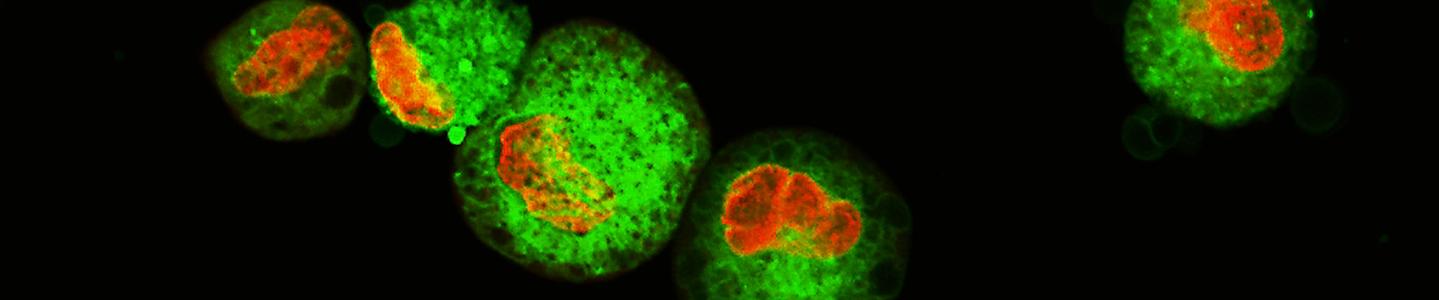 Leukemic cells labeled with fluorescent molecules