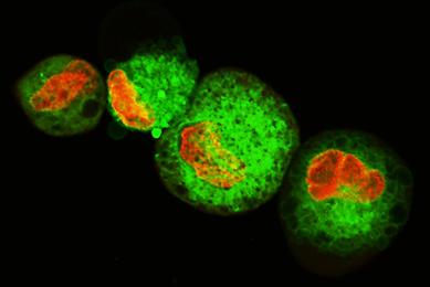 Leukemic cells labeled with fluorescent molecules