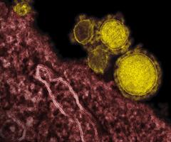 Grainy, pink and yellow spheres of Middle East respiratory syndrome coronavirus.