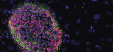 Purple and green induced pluripotent stem cells.