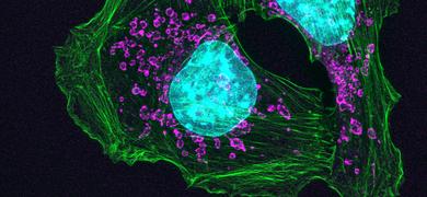 Purple and green top mouse skin cancer cells.