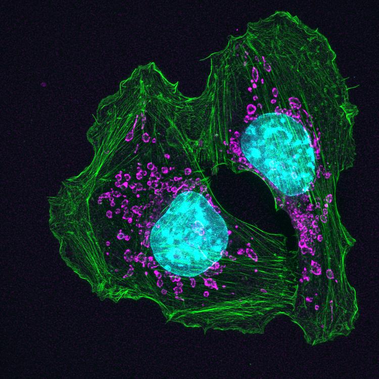 Purple and green top mouse skin cancer cells.