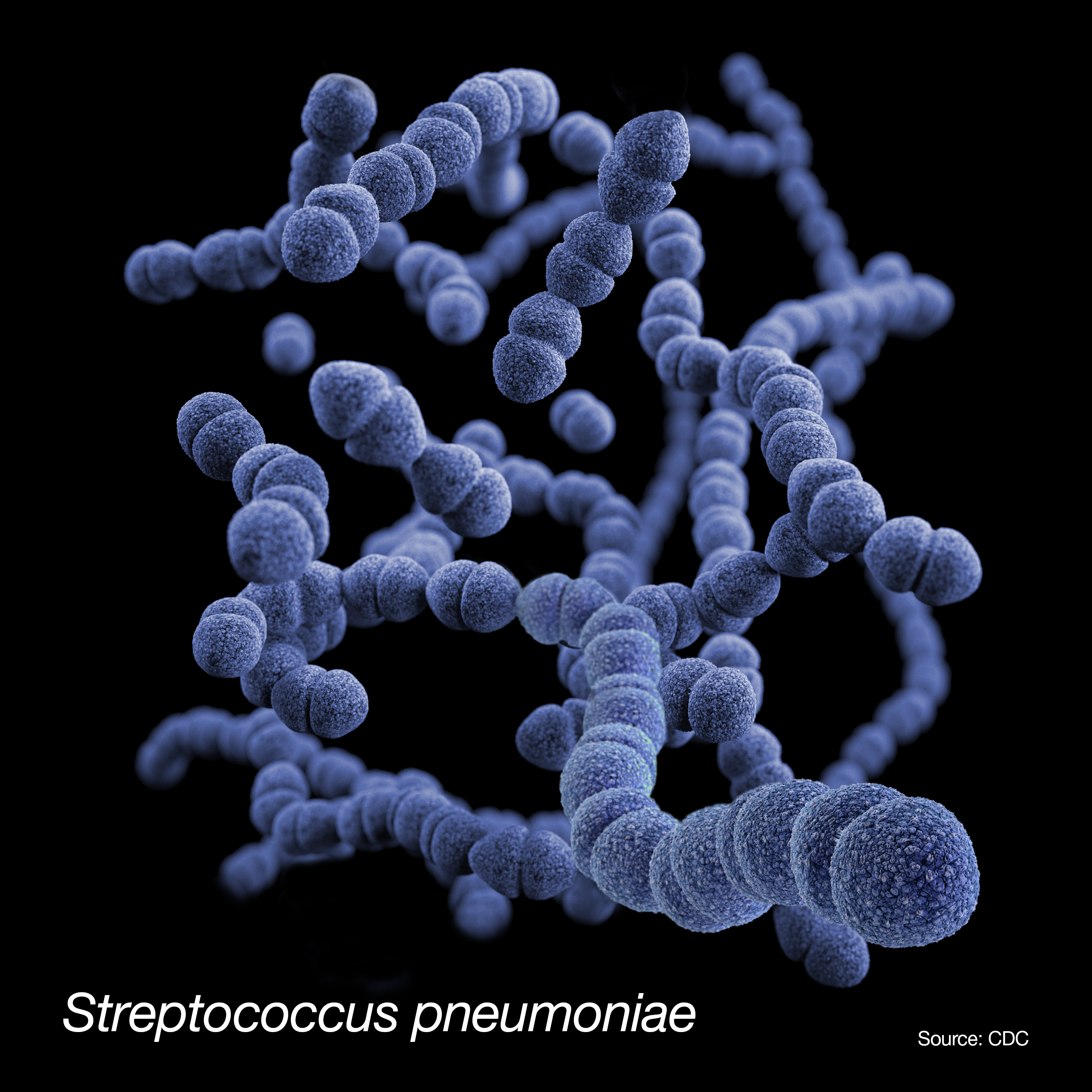 Strings of purple balls of Streptococcus pyogenes bacteria.