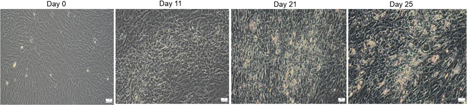 Differentiation of White Preadipocytes into Mature Adipocytes