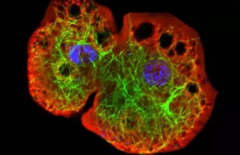 Fluorescent red, green, and blue cluster of cells.