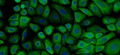 Small, fluorescent green and blue, spherical lung cells.