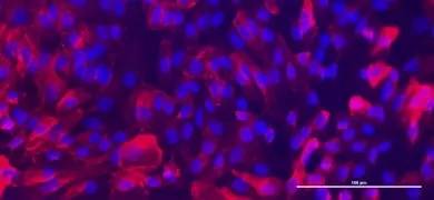 Microscopic image showing fluorescent purple renal proximal tubular epithelial cells with blue-stained nuclei. The cells are densely packed and exhibit a vibrant purple fluorescence, indicating the presence of specific markers or stains. A scale bar at the bottom right indicates a length of 100 µm.