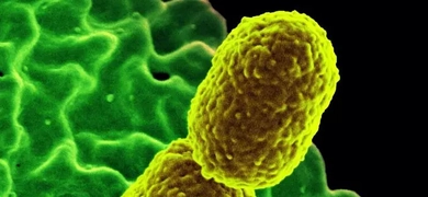 Scanning electron microscopic (SEM) image showing two mustard-colored, rod-shaped, carbapenem-resistant Klebsiella pneumoniae (CRKP) bacteria interacting with a green-colored human white blood cell (WBC), specifically a neutrophil.