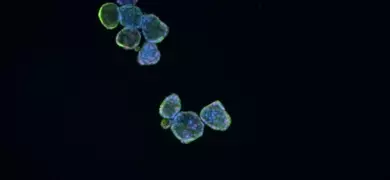 Microscopy image of organoid cells stained with 488 ck20, showing clustered green and blue fluorescent cells against a dark background.