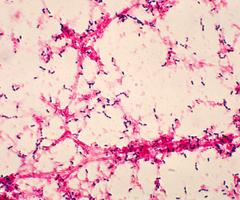 S. pneumo from blood bacteria