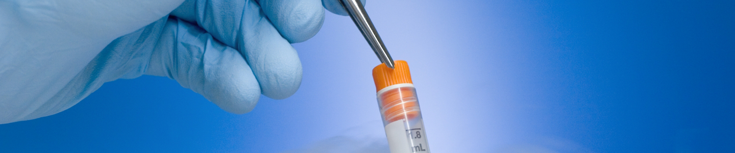 Gloved hand using tweezers to hold frozen vial above open liquid nitrogen cryopreservation tank.