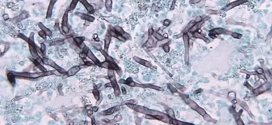 Gray and ice blue bipolaris hawaiiensis fungus.