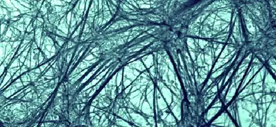 Microscopic image showing a dense network of green and blue neuronal cells derived from embryonic stem (ES) cells. The neurons are interconnected with numerous branching structures, creating a complex web-like pattern.