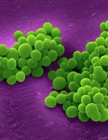 Cluster of green, grape-shaped methicillin-resistant Staphylococcus aureus bacteria.