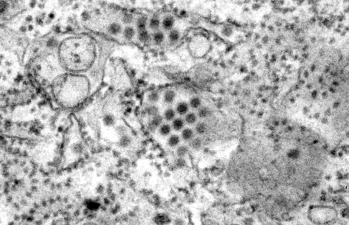 Grayscale image of Dengue virus particles in this specimen