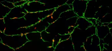 Fluorescent microscopy image of human aortic endothelial cells showing green branching structures with scattered red puncta on a black background, representing cellular networks and markers.