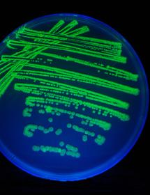 Petri dish filled with bright-blue and green media and cells in a line and spot pattern.