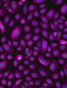 Bronchial Epithelial family (CRL-4012)_03-02_Cytoe 1 .jpg
