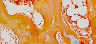 Bone and bone marrow cells.