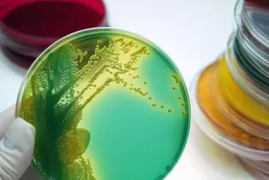 Microbiology, bacterial culture plates