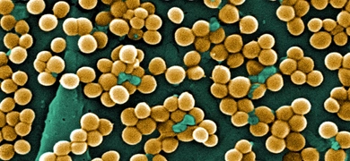 Yellow spheres of methicillin-resistant Staphylococcus aureus clustered together.