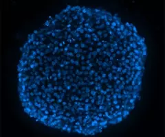 A bright-blue, fluorescent, DAPI stain sphere with a black background.