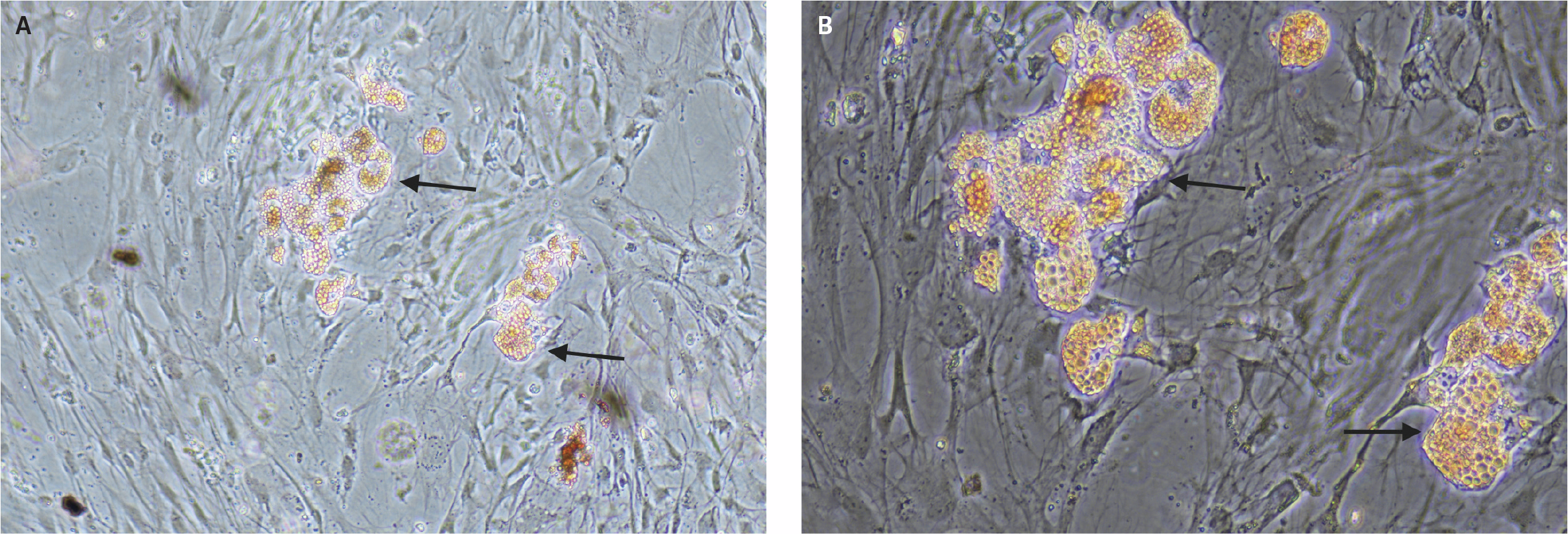 Microscopic images showing Oil Red O staining of lipid droplets after adipogenic differentiation of DSCS cells: (A) 20X magnification and (B) 10X magnification, with red-stained lipid droplets visible inside mature adipocytes indicated by arrows.