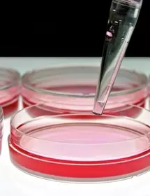 Tissue culture dish filled with culture media