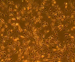 Orange and black fluoroscent, web-like melanocyte cells.