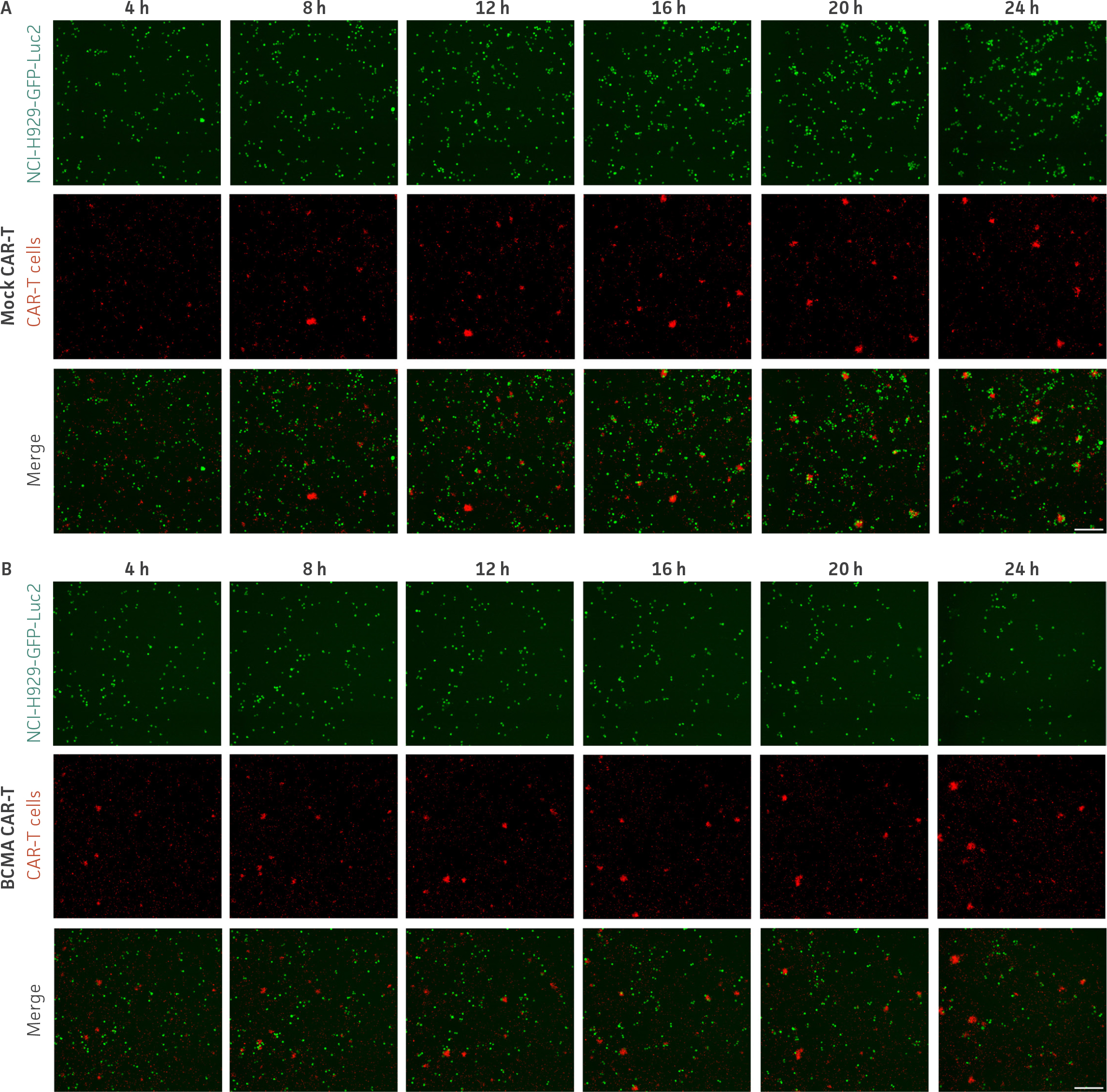 Time-lapse microscopy images of NCI-H929-GFP-Luc2 cells co-cultured with either Mock or BCMA CAR-T cells over 24 hours, showing green fluorescence for cancer cells and red fluorescence for CAR-T cells. Merged images illustrate cell interactions at multiple time points.