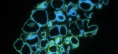 Fluorescent microscopy image of blue and green organoid cells, showing a clustered arrangement with varied shapes and sizes resembling interconnected cellular structures.